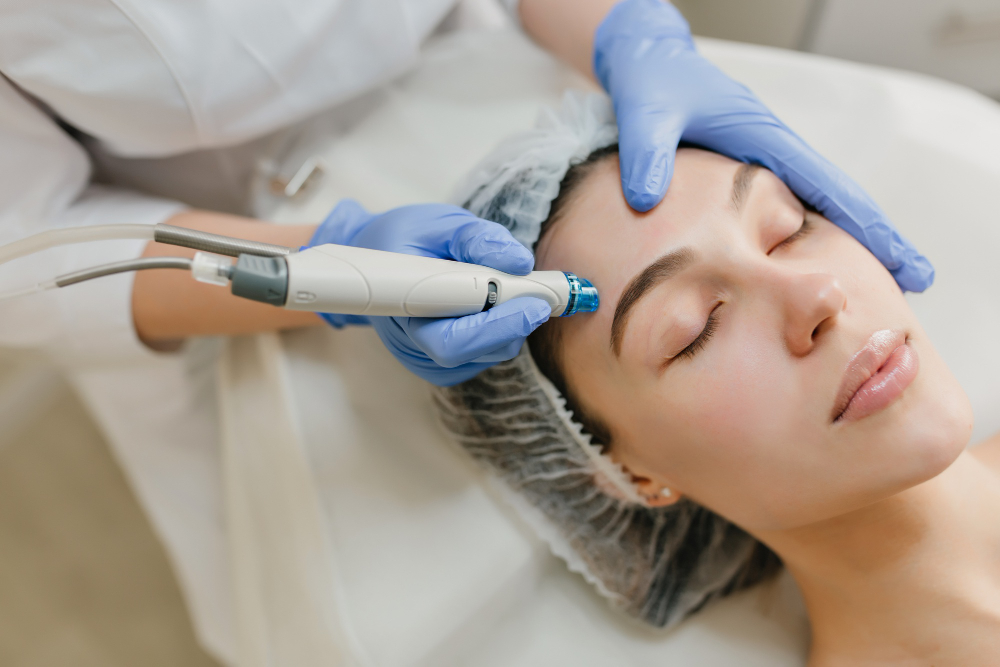 Unveiling the Miraculous Benefits of Microneedling