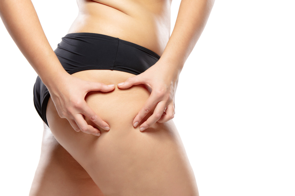 Say Goodbye to Cellulite with Cutting-Edge Body Sculpting Strategies